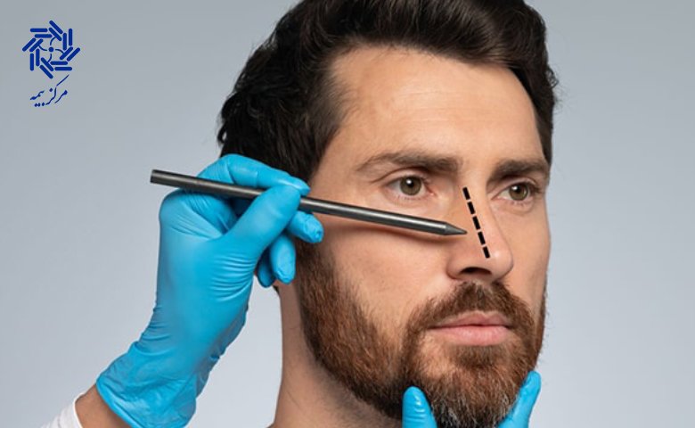 استفاده از بیمه تکمیلی برای عمل بینی